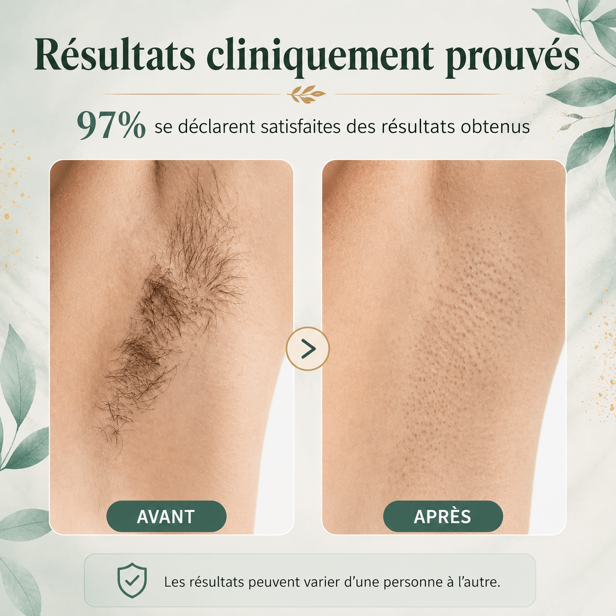 Huile de Cyperus Rotundus — Soin Anti-Repousse - Yunae Beauty CH