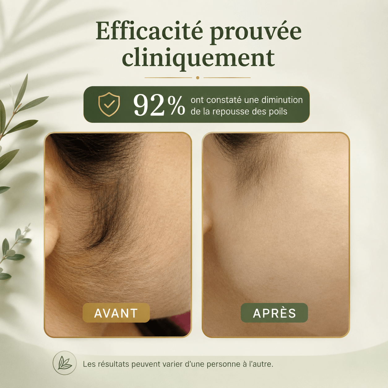 Huile de Cyperus Rotundus — Soin Anti-Repousse - Yunae Beauty CH