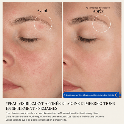 Masque thérapie LED - Yunae Beauty CH