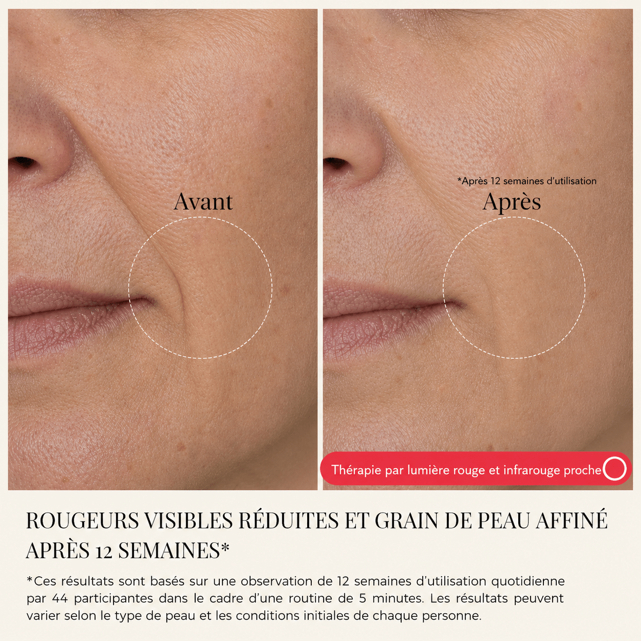 Masque thérapie LED - Yunae Beauty CH