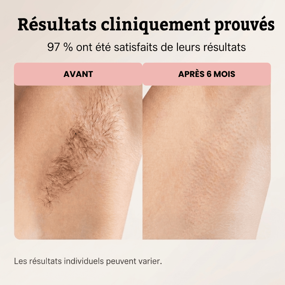 Moins de poils. Moins souvent. - Yunae Beauty CH