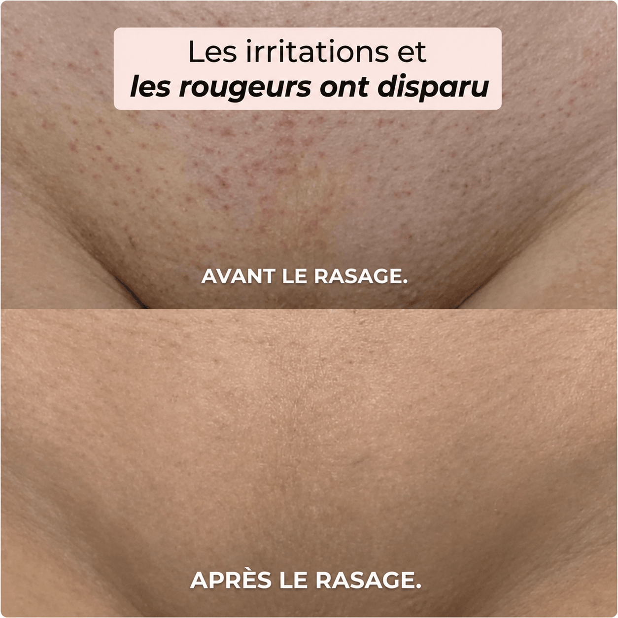 Rasoir 2 en 1 Maillot et Corps Yunaé™ - Yunae Beauty CH
