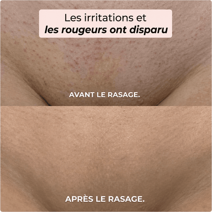 Rasoir 2 en 1 Maillot et Corps Yunaé™ - Yunae Beauty CH