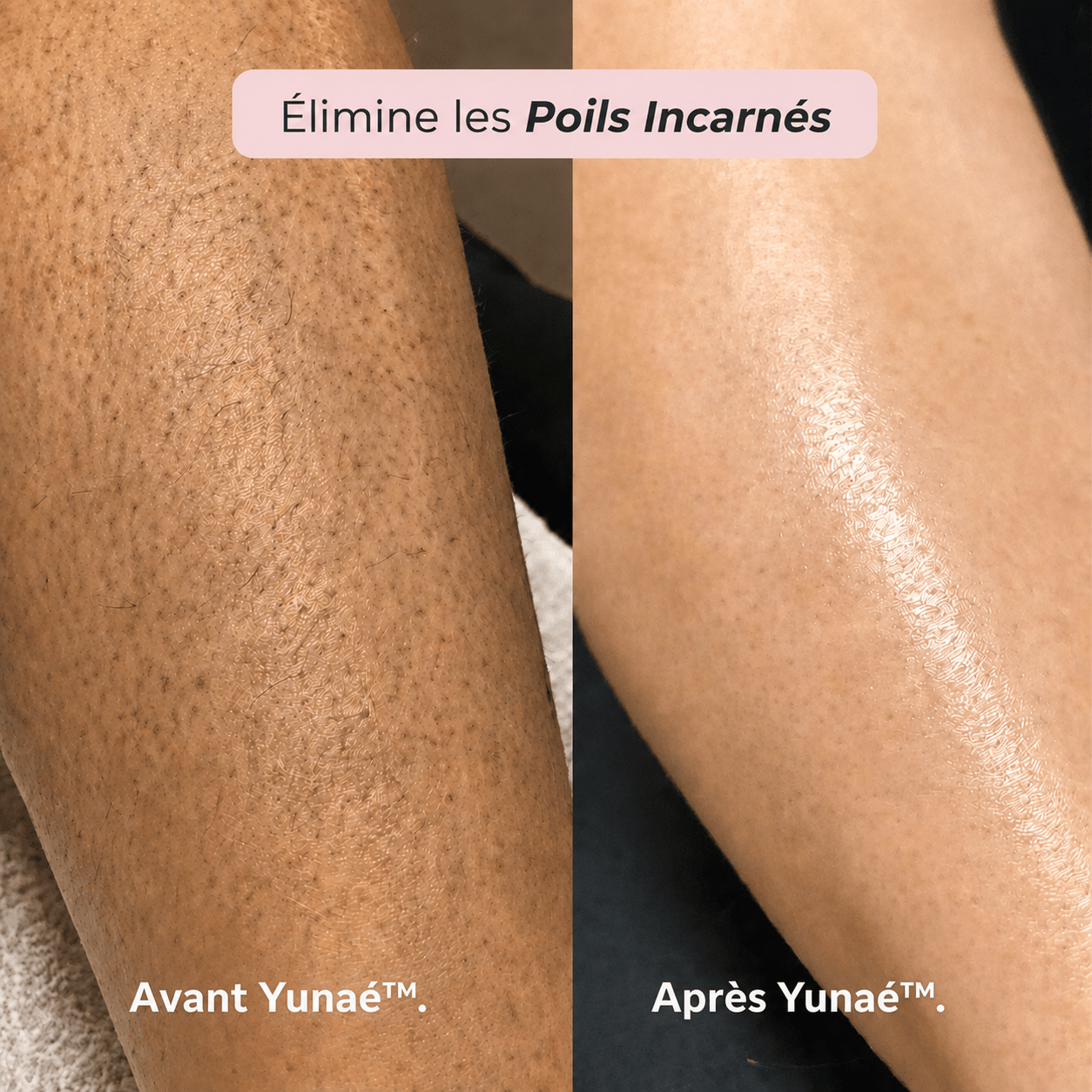 Rasoir 2 en 1 Maillot et Corps Yunaé™ - Yunae Beauty CH