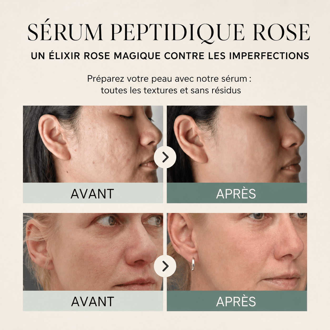 Sérum Peptides PDRN - Yunae Beauty CH
