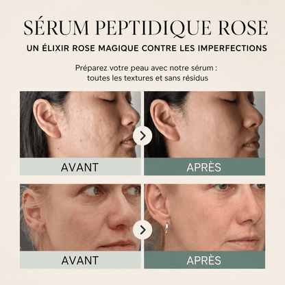 Sérum Peptides PDRN - Yunae Beauty CH
