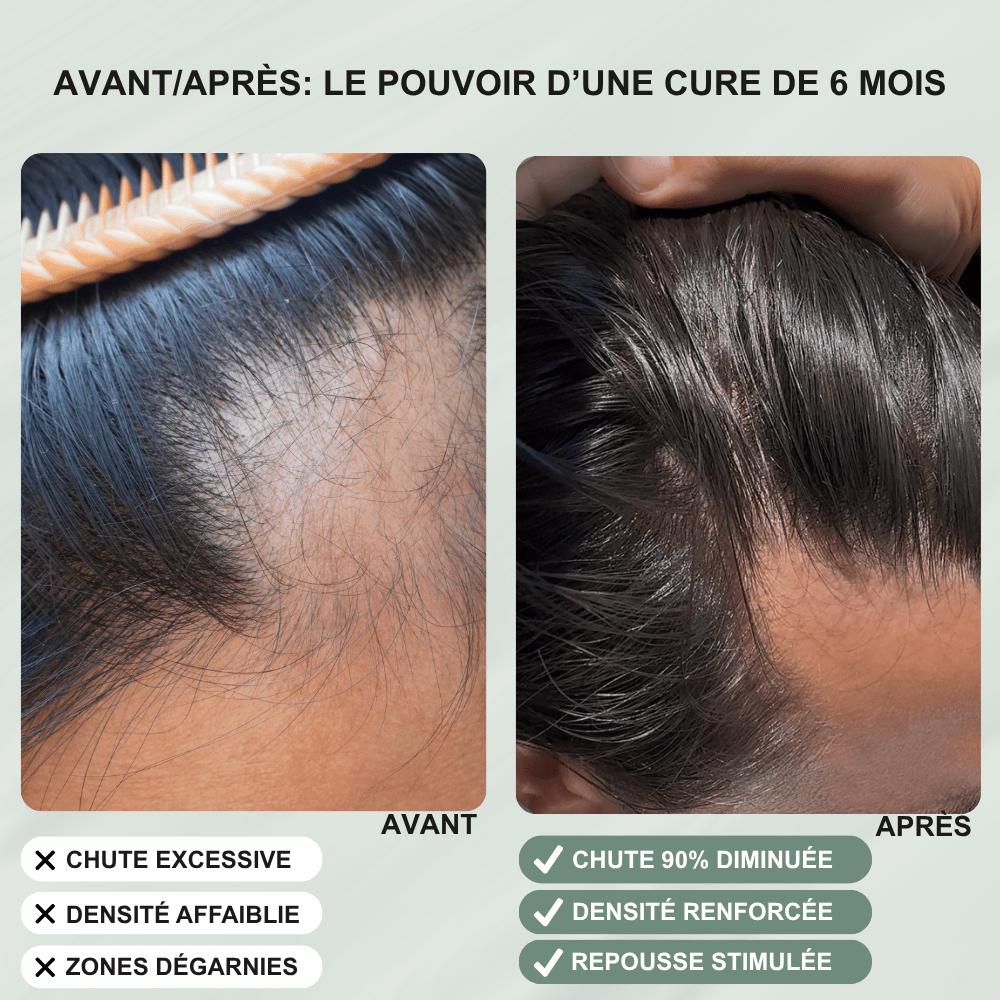 Shampoing élixir anti - chute - Yunaé Beauty CH