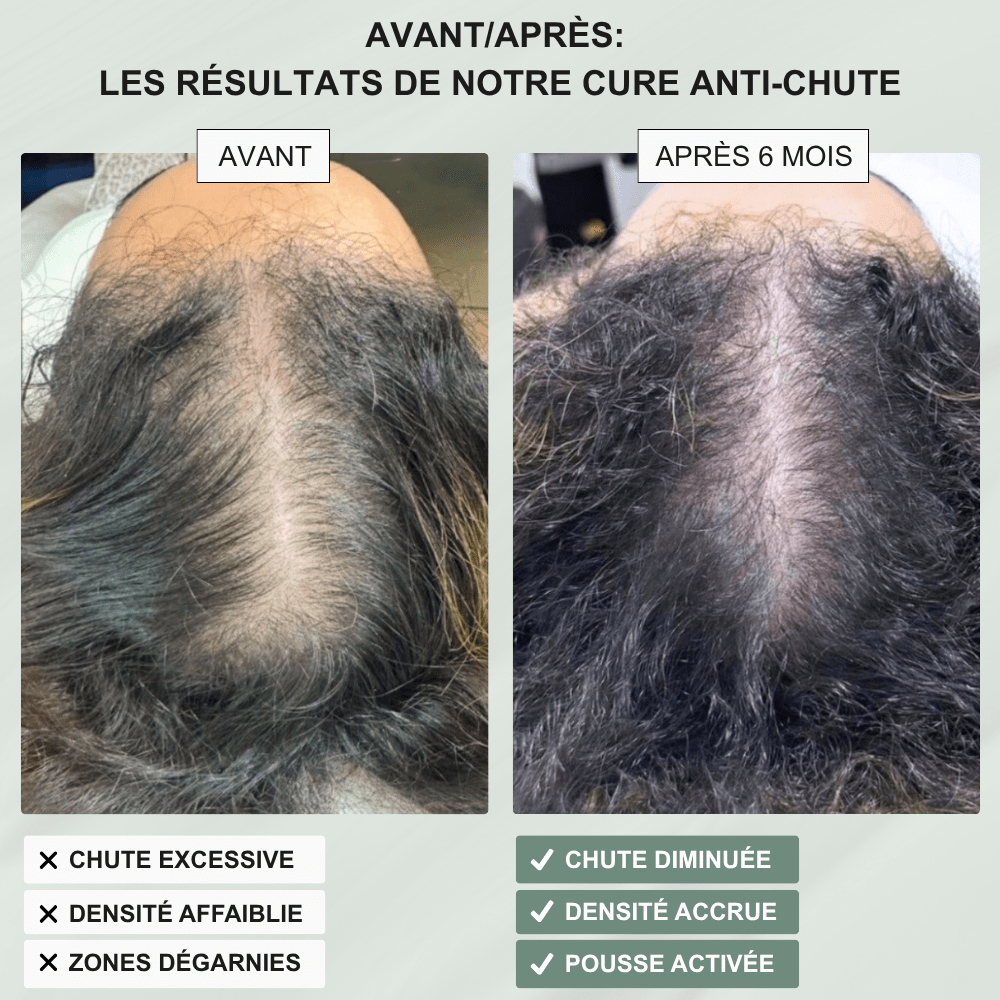 Shampoing Solide Anti - Chute — Élixir Concentré - Yunae Beauty CH