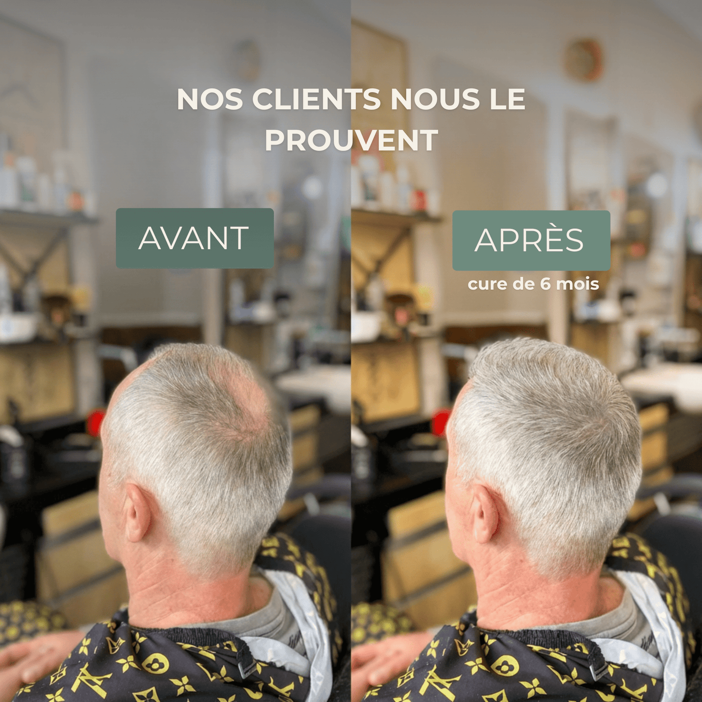 Shampoing Solide Anti - Chute — Élixir Concentré - Yunae Beauty CH