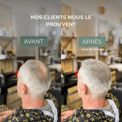 Shampoing Solide Anti - Chute — Élixir Concentré - Yunae Beauty CH