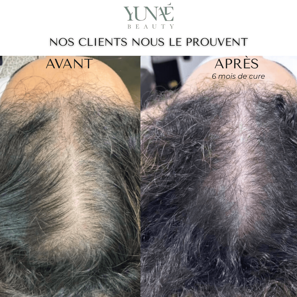 Shampoing Solide Anti - Chute — Élixir Concentré - Yunae Beauty CH