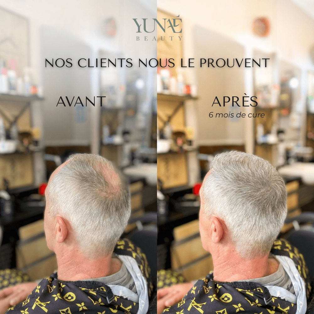 Shampoing Solide Anti - Chute — Élixir Concentré - Yunae Beauty CH