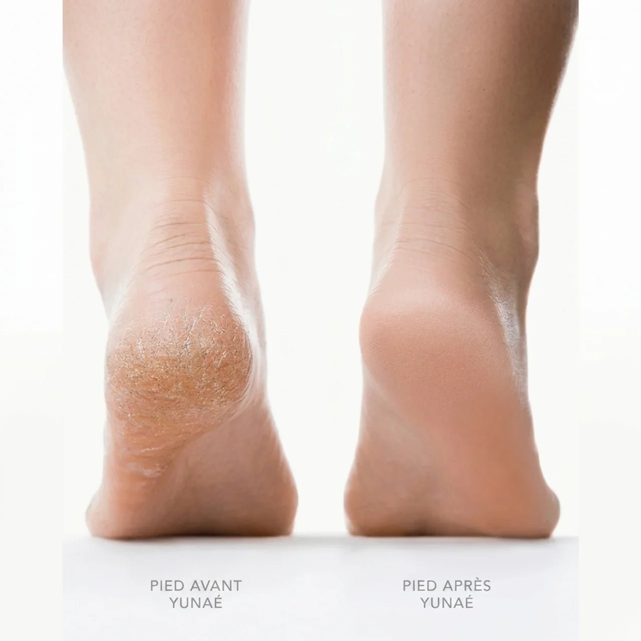 Yunaé Silk 3 Pro - Yunae Beauty CH